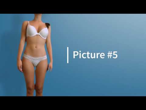 How to take photo for Tummy Tuck online consultation