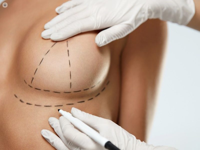 Breast Explant Jupiter - Implant Removal Miami