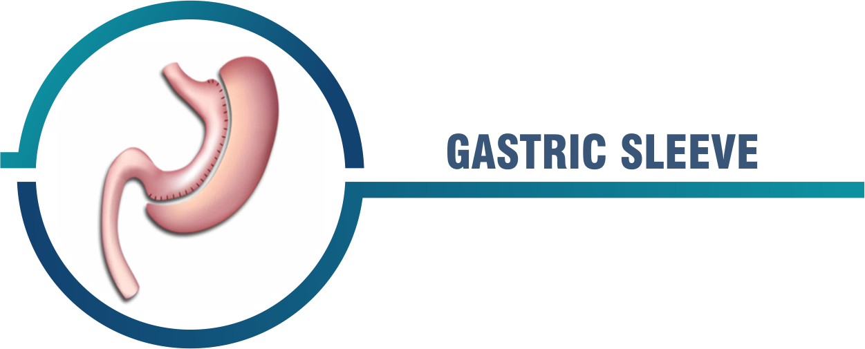 Gastric Sleeve Surgery Miami