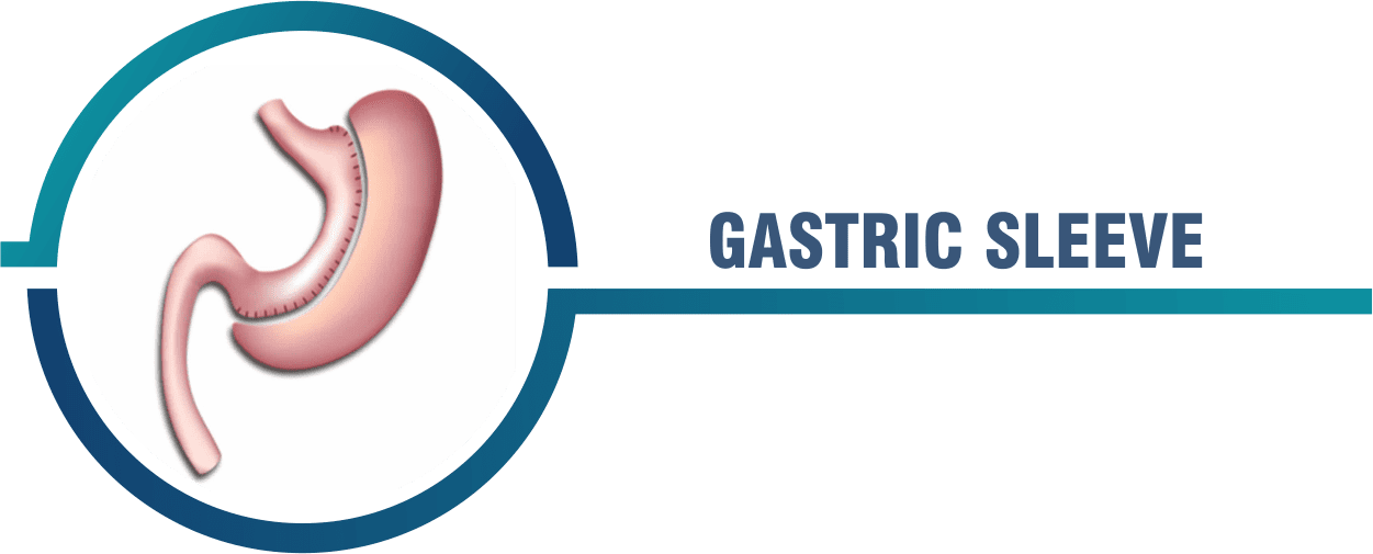 Gastric Sleeve Surgery Miami