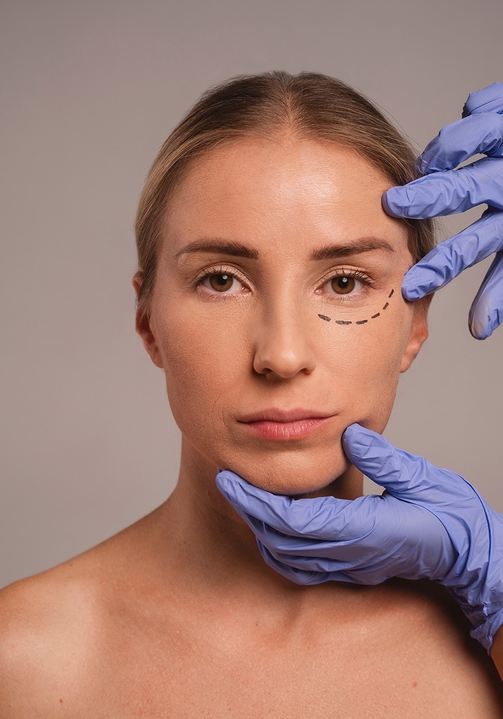 Eyelid surgery blepharoplasty results in Miami